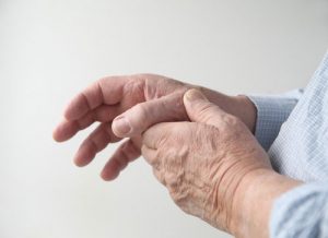 Arthritis of The Thumb